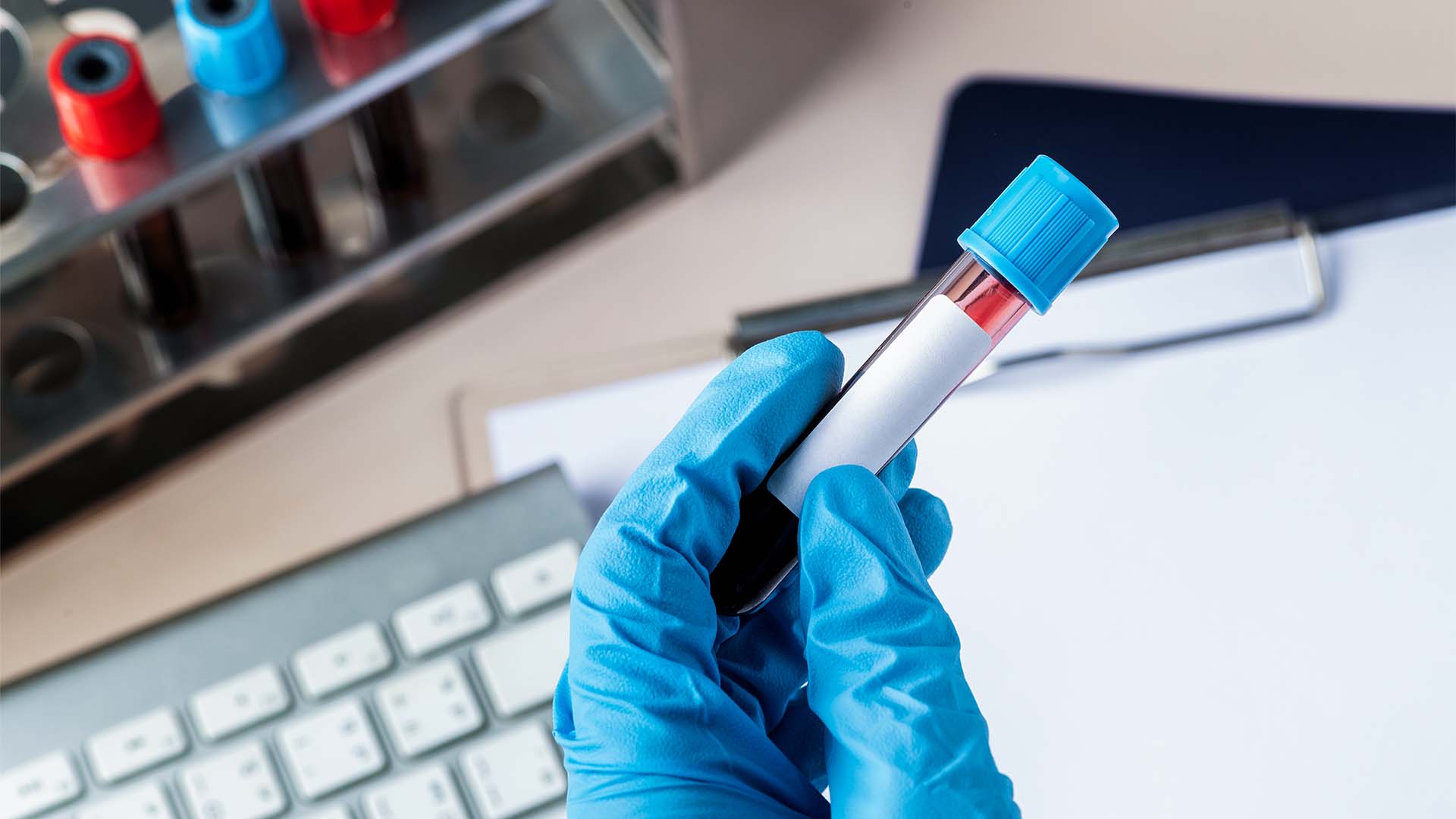 Evde Laboratuvar Hizmetleri